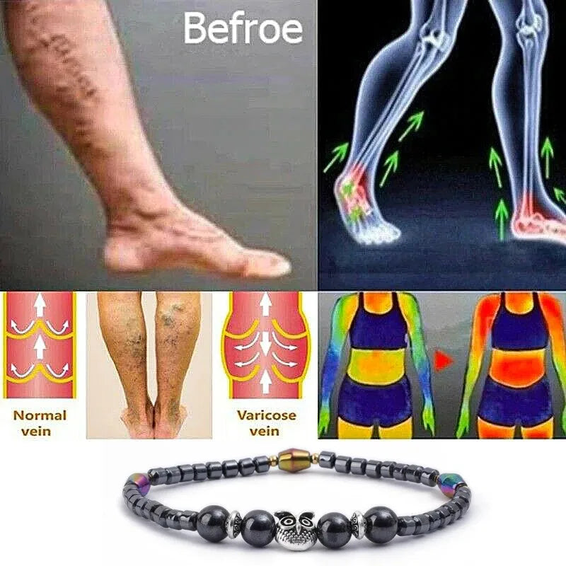 ENERVIA - 
Molded Slimming Magnetic Therapy Health Magnet Ankle Chains Relieve Fatigue Weight Loss Magnet Anklets Natural Stones Bracelets